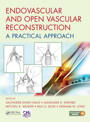 Cover of the book Endovascular and Open Vascular Reconstruction by Rughani Amar, Stephen Dixon, Chris Franklin