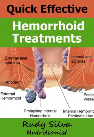 Cover of the book Quick Effective Hemorrhoid Treatments by Dr S Om Goel