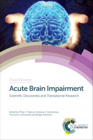 Cover of the book Acute Brain Impairment by Rebecca Melen, David Liptrot, Graeme Hogarth, Lee Higham, Jun-Long Zhang, David Mills, Andrew Phillips