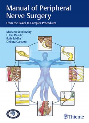 Cover of the book Manual of Peripheral Nerve Surgery by Guenter Schmidt
