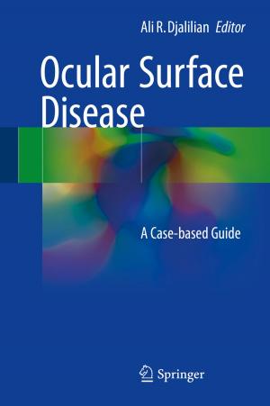Cover of the book Ocular Surface Disease by Michael Barot, Jesús Arturo Jiménez González, José-Antonio de la Peña
