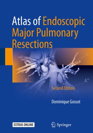 Cover of the book Atlas of Endoscopic Major Pulmonary Resections by Florence Metz