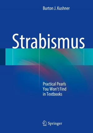 Cover of the book Strabismus by Arben Çela, Mongi Ben Gaid, Xu-Guang Li, Silviu-Iulian Niculescu