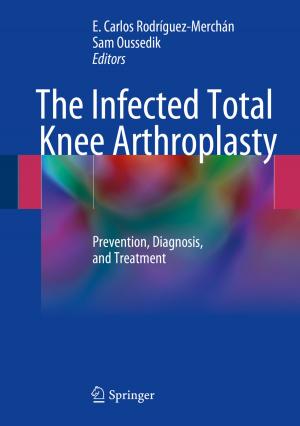 Cover of the book The Infected Total Knee Arthroplasty by Igor Schagaev, Kaegi Thomas