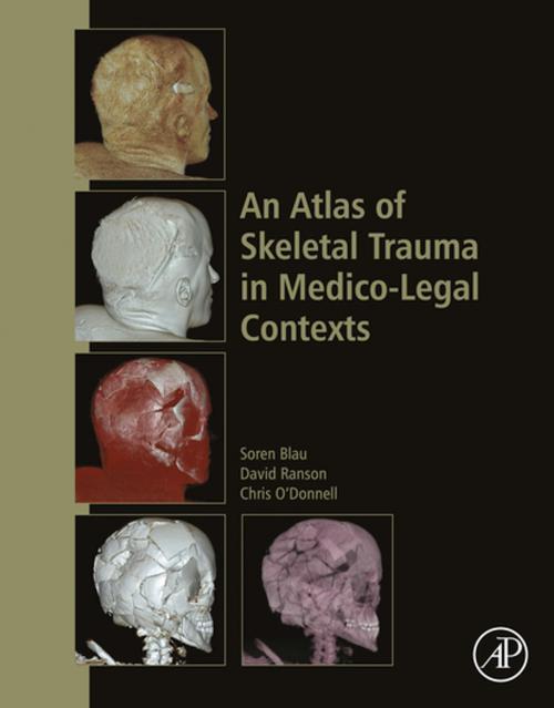 Cover of the book An Atlas of Skeletal Trauma in Medico-Legal Contexts by David Ranson, Soren Blau, Chris O'Donnell, Elsevier Science