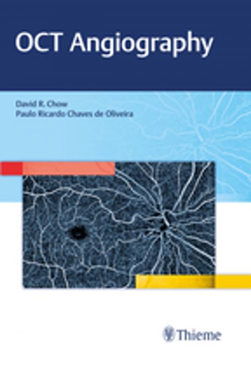Cover of the book OCT Angiography by David Chow, Thieme