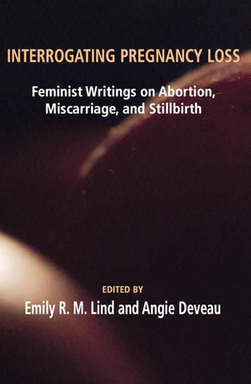 Cover of the book Interrogating Pregnancy Loss by , Demeter Press