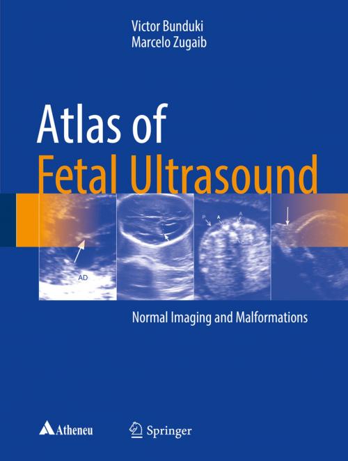 Cover of the book Atlas of Fetal Ultrasound by Victor Bunduki, Marcelo Zugaib, Springer International Publishing