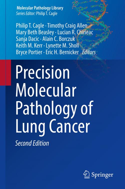 Cover of the book Precision Molecular Pathology of Lung Cancer by , Springer International Publishing