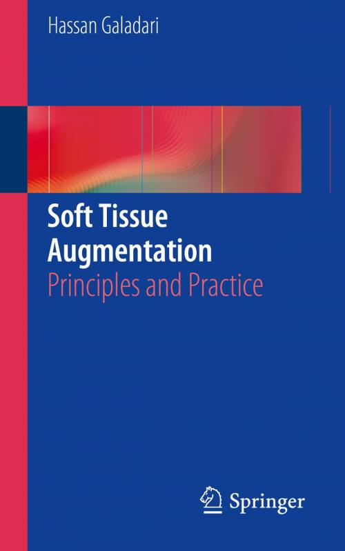 Cover of the book Soft Tissue Augmentation by Hassan Galadari, Springer Berlin Heidelberg