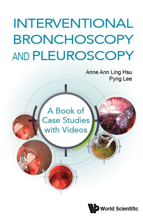 Cover of the book Interventional Bronchoscopy and Pleuroscopy by Anne Ann Ling Hsu, Pyng Lee, World Scientific Publishing Company