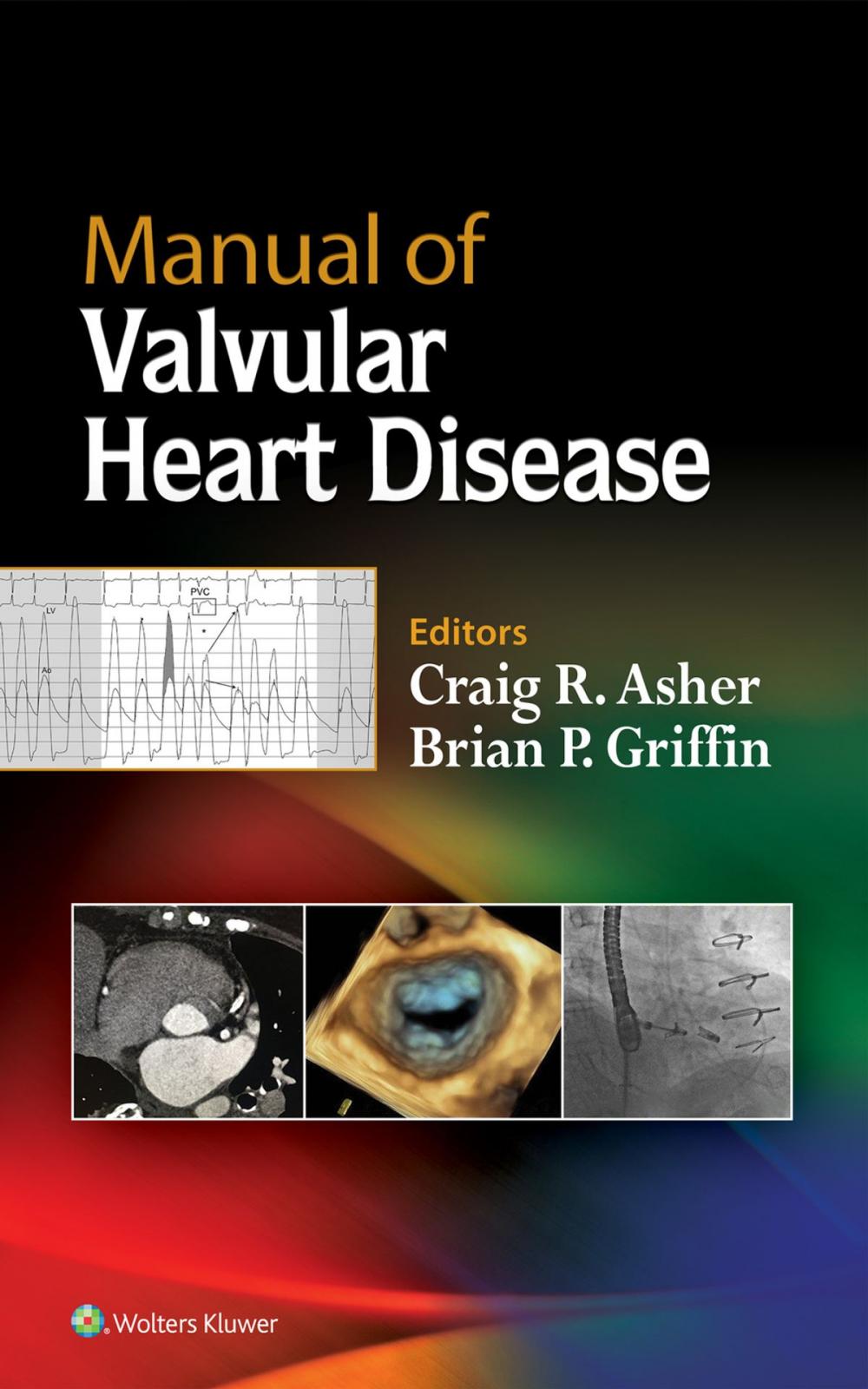 Big bigCover of Manual of Valvular Heart Disease