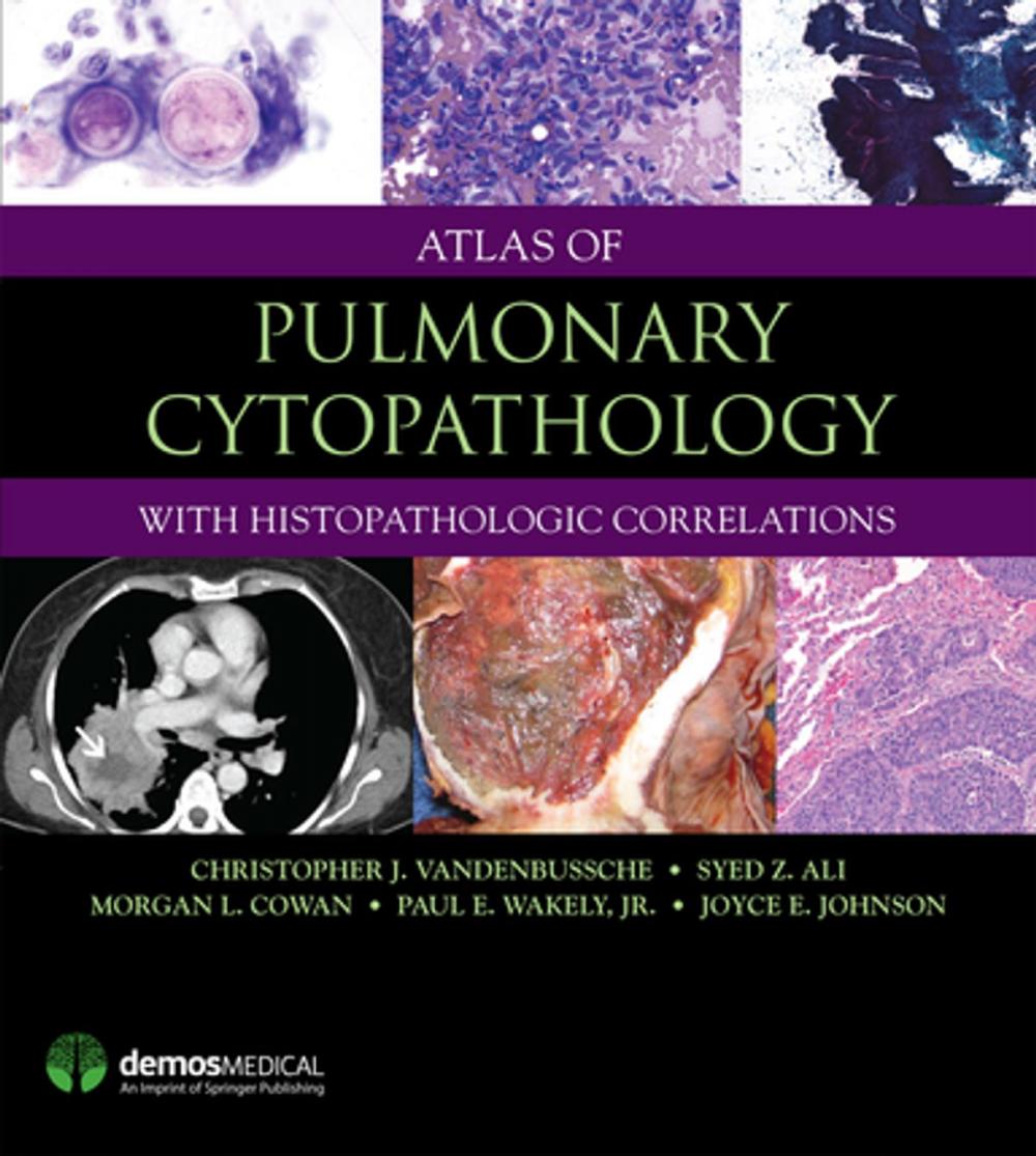 Big bigCover of Atlas of Pulmonary Cytopathology