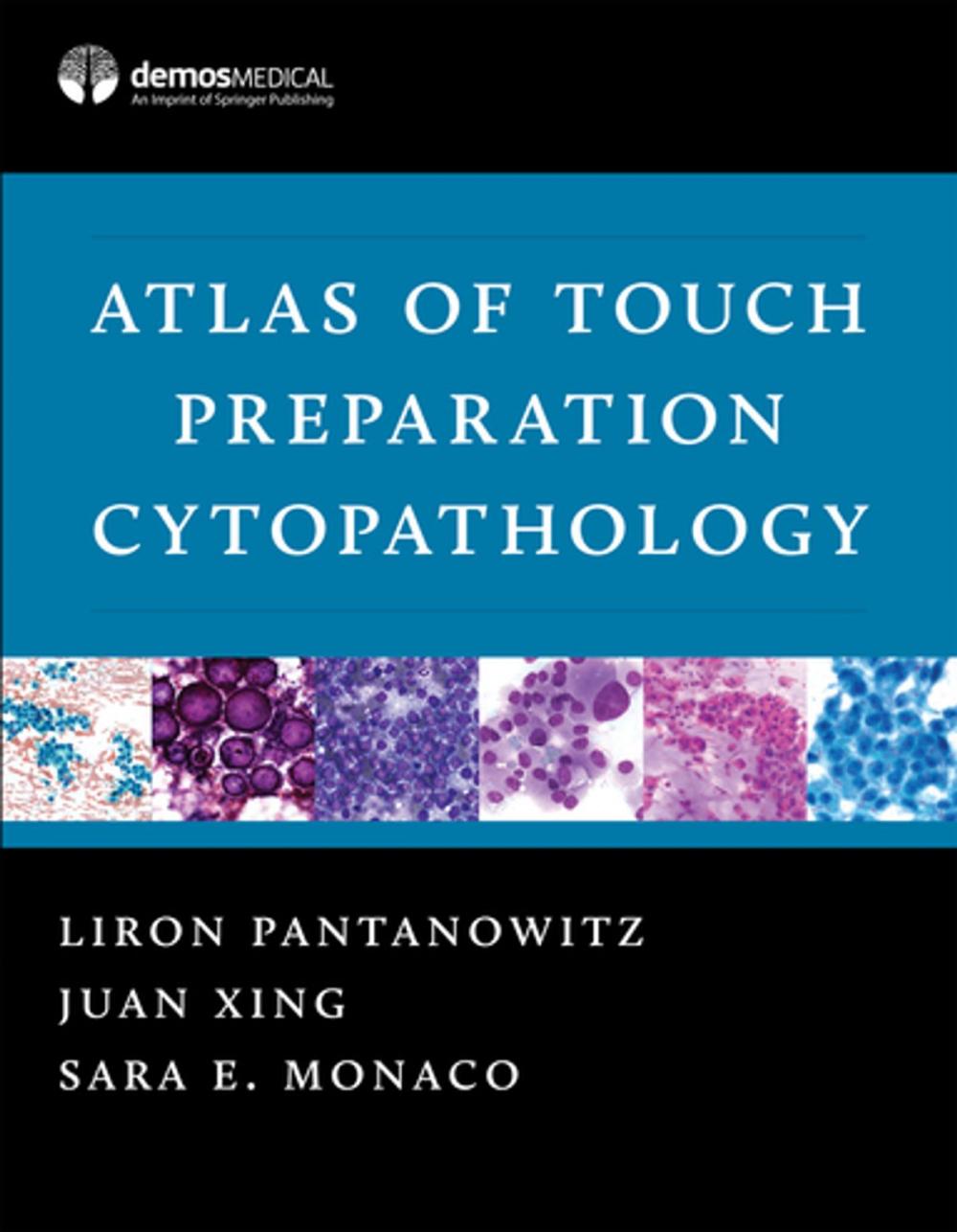 Big bigCover of Atlas of Touch Preparation Cytopathology