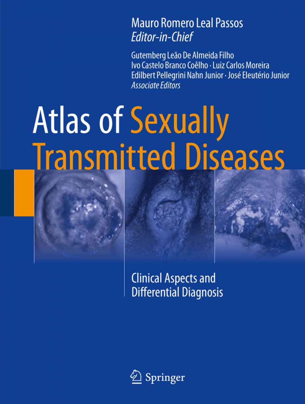 Big bigCover of Atlas of Sexually Transmitted Diseases
