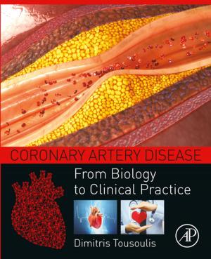 Book cover of Coronary Artery Disease