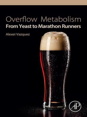Cover of the book Overflow Metabolism by Jasbir Singh Arora, Ph.D., Mechanics and Hydraulics, University of Iowa