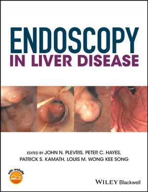 Cover of the book Endoscopy in Liver Disease by Judith A. Muschla, Gary Robert Muschla, Erin Muschla-Berry