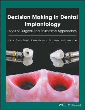 Cover of the book Decision Making in Dental Implantology by Derald Wing Sue, Miguel E. Gallardo, Helen A. Neville