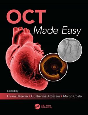 Cover of the book OCT Made Easy by C. Anandharamakrishnan, S. Padma Ishwarya