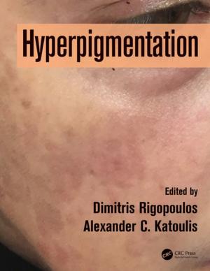 Cover of the book Hyperpigmentation by R.C. Gunning
