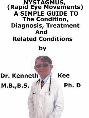 bigCover of the book Nystagmus, (Rapid Eye Movements) A Simple Guide To The Condition, Diagnosis, Treatment And Related Conditions by 