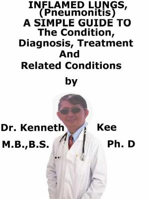 Book cover of Inflamed Lungs, (Pneumonitis) A Simple Guide To The Condition, Diagnosis, Treatment And Related Conditions