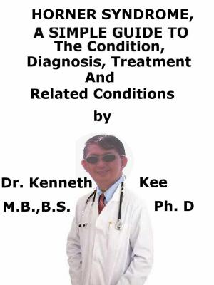 Book cover of Horner Syndrome, A Simple Guide To The Condition, Diagnosis, Treatment And Related Conditions