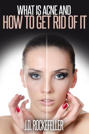Cover of the book What is Acne and How to Get Rid of It by J.D. Rockefeller