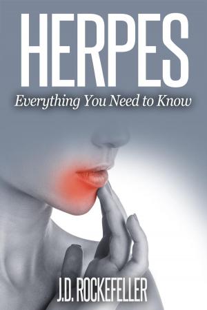 Cover of Herpes: Everything You Need To Know