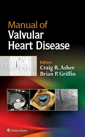 Cover of the book Manual of Valvular Heart Disease by Robert J. Hoffman