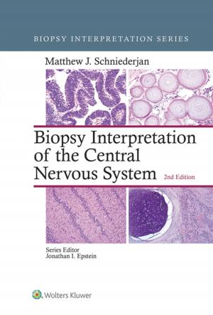 Cover of the book Biopsy Interpretation of the Central Nervous System by James M. Cox