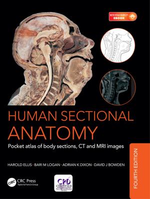 Book cover of Human Sectional Anatomy