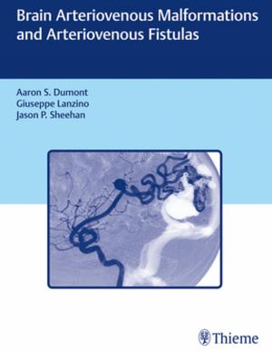 Cover of the book Brain Arteriovenous Malformations and Arteriovenous Fistulas by 