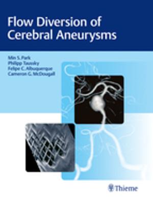 Cover of the book Flow Diversion of Cerebral Aneurysms by John A. McCurdy, Samuel M. Lam