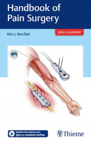 Cover of the book Handbook of Pain Surgery by Gundula Staatz, Dagmar Honnef