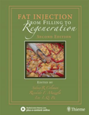Cover of the book Fat Injection by H. Burkhard Dick, Ronald D. Gerste, Tim Schultz