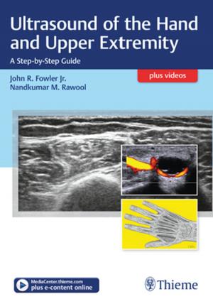 Cover of the book Ultrasound of the Hand and Upper Extremity by Hans-Ulrich Hecker, Angelika Steveling