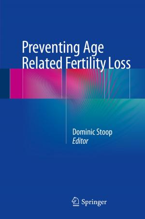Cover of the book Preventing Age Related Fertility Loss by Vladimir Kadets, Miguel Martín, Javier Merí, Antonio Pérez