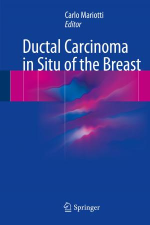 Cover of the book Ductal Carcinoma in Situ of the Breast by Rollin K. Daniel, Péter Pálházi