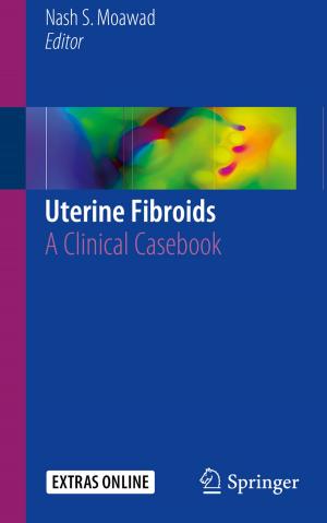 Cover of the book Uterine Fibroids by Heidi Thomson