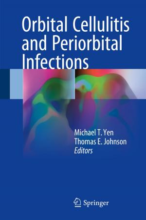 Cover of the book Orbital Cellulitis and Periorbital Infections by Stefano Crespi Reghizzi, Luca Breveglieri, Angelo Morzenti