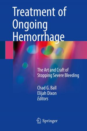 Cover of the book Treatment of Ongoing Hemorrhage by Iosif I. Androulidakis