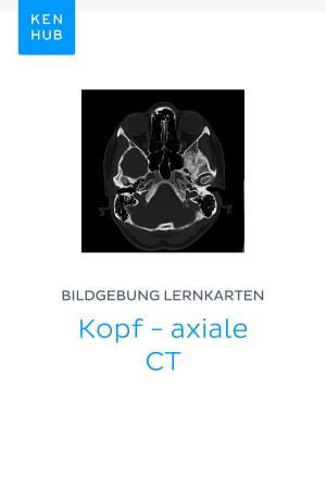 Book cover of Bildgebung Lernkarten: Kopf - axiale CT