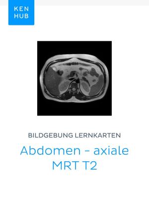 Cover of Bildgebung Lernkarten: Abdomen - axiale MRT T2