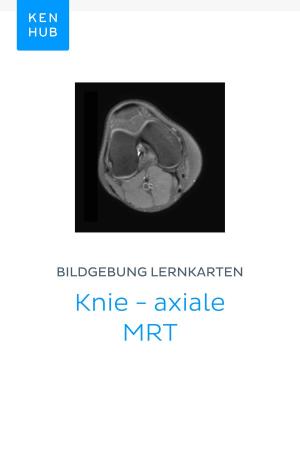 Book cover of Bildgebung Lernkarten: Knie - axiale MRT