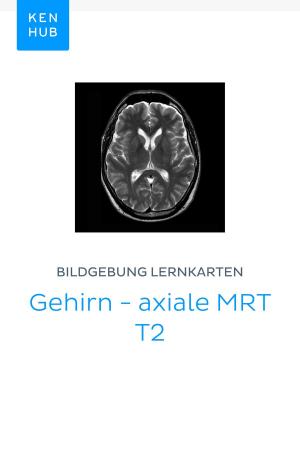 Cover of Bildgebung Lernkarten: Gehirn - axiale MRT T2