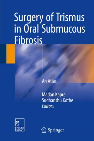 Cover of the book Surgery of Trismus in Oral Submucous Fibrosis by Yaji Huang, Jiang Wu, Weiguo Zhou, Dongjing Liu, Qizhen Liu