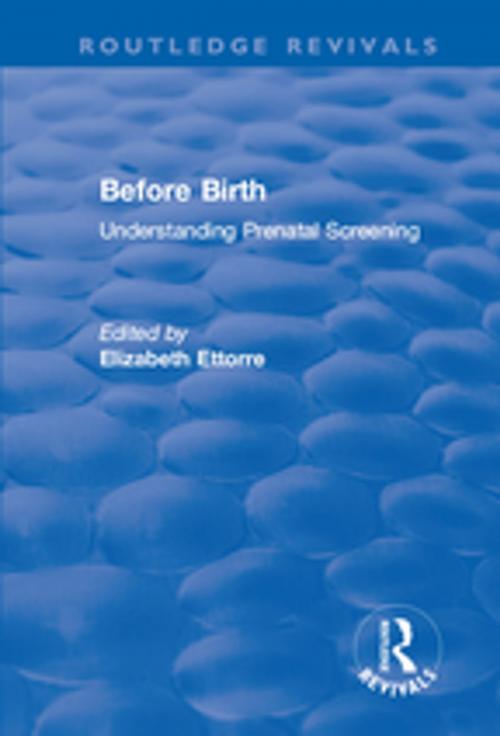 Cover of the book Before Birth by , Taylor and Francis