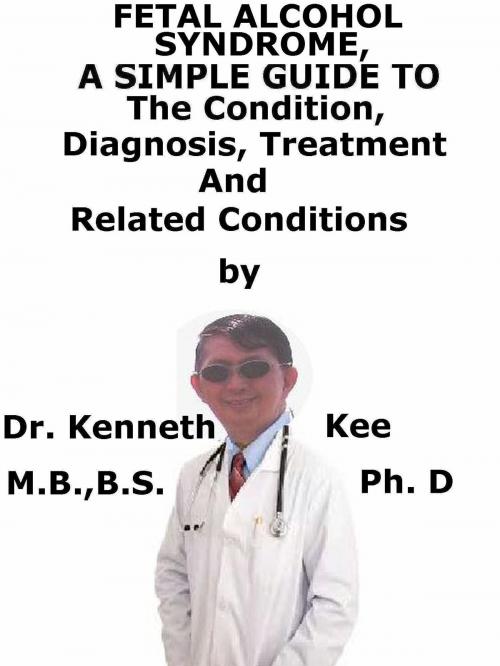 Cover of the book Fetal Alcohol Syndrome, A Simple Guide To The Condition, Diagnosis, Treatment And Related Conditions by Kenneth Kee, Kenneth Kee